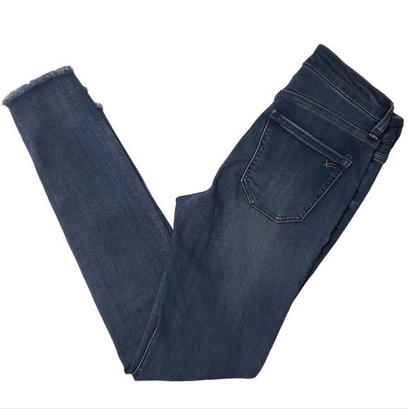 William Rast Highrise Ankle Jeans Raw Hem Exposed Button Front Size 25 - Picture 5 of 14